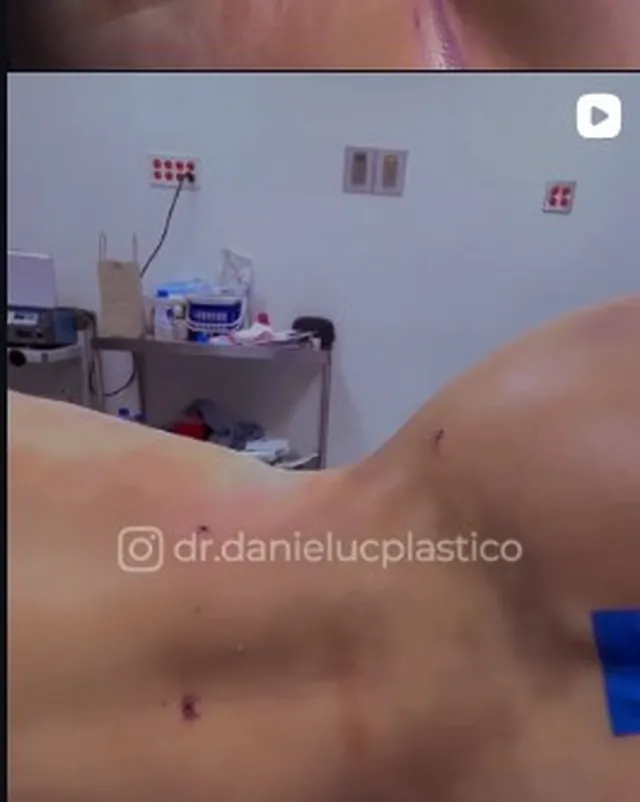 Detalle de un procedimiento en consultorio