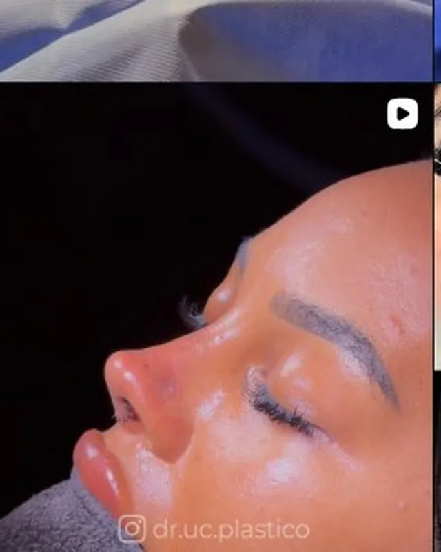 Perfil de rostro en recuperación